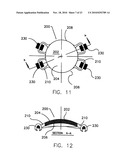 REFRACTIVE INTRAOCULAR IMPLANT LENS AND METHOD diagram and image