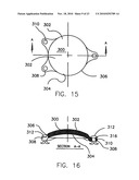 REFRACTIVE INTRAOCULAR IMPLANT LENS AND METHOD diagram and image