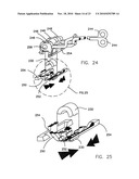 REFRACTIVE INTRAOCULAR IMPLANT LENS AND METHOD diagram and image