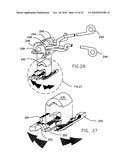 REFRACTIVE INTRAOCULAR IMPLANT LENS AND METHOD diagram and image