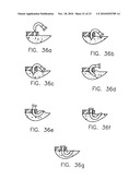 REFRACTIVE INTRAOCULAR IMPLANT LENS AND METHOD diagram and image