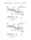 REFRACTIVE INTRAOCULAR IMPLANT LENS AND METHOD diagram and image