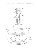 Prosthetic Ligament System for Knee Joint diagram and image