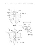 Prosthetic Ligament System for Knee Joint diagram and image