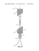 Prosthetic Ligament System for Knee Joint diagram and image