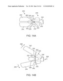 AUTOMATED TISSUE RETENTION SYSTEM diagram and image