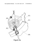 FLEXIBLE HANG-OFF ARRANGEMENT FOR A CATENARY RISER diagram and image