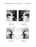 VISUALIZATION OF 3D IMAGES IN COMBINATION WITH 2D PROJECTION IMAGES diagram and image