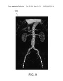 SOFT TISSUE SEGMENTATION USING A BONE ATLAS diagram and image