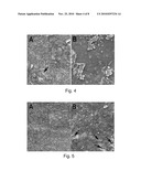 METHOD OF USING AN EXTRACELLULAR MATRIX TO ENHANCE CELL TRANSPLANT SURVIVAL AND DIFFERENTIATION diagram and image