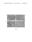 METHOD OF USING AN EXTRACELLULAR MATRIX TO ENHANCE CELL TRANSPLANT SURVIVAL AND DIFFERENTIATION diagram and image