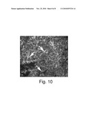 METHOD OF USING AN EXTRACELLULAR MATRIX TO ENHANCE CELL TRANSPLANT SURVIVAL AND DIFFERENTIATION diagram and image