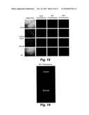 SILICA-BASED NANOPARTICLES AND METHODS OF STIMULATING BONE FORMATION AND SUPPRESSING BONE RESORPTIOIN THROUGH MODULATION OF NF-KB diagram and image