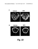 SILICA-BASED NANOPARTICLES AND METHODS OF STIMULATING BONE FORMATION AND SUPPRESSING BONE RESORPTIOIN THROUGH MODULATION OF NF-KB diagram and image