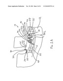 CT-based, Side-loading Surgical and Laboratory Dental Implant Guide System and Methodology of Use diagram and image