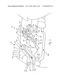 CT-based, Side-loading Surgical and Laboratory Dental Implant Guide System and Methodology of Use diagram and image