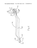 CT-based, Side-loading Surgical and Laboratory Dental Implant Guide System and Methodology of Use diagram and image