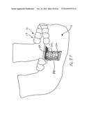 CT-based, Side-loading Surgical and Laboratory Dental Implant Guide System and Methodology of Use diagram and image