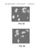 METHODS AND MATERIALS FOR DETECTING GENE AMPLIFICATION diagram and image