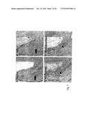 METHODS FOR ASSESSING THE RISK FOR DEVELOPMENT OF CARDIOVASCULAR DISEASE diagram and image