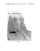 METHODS FOR ASSESSING THE RISK FOR DEVELOPMENT OF CARDIOVASCULAR DISEASE diagram and image