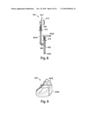 DYNAMIC LOWER LIMB REHABILITATION ROBOTIC APPARATUS AND METHOD OF REHABILITATING HUMAN GAIT diagram and image