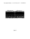 METHODS AND COMPOSITIONS FOR TREATING OPHTHALMIC CONDITIONS WITH RETINYL DERIVATIVES diagram and image