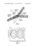 Steerable Capsule Apparatus and Method diagram and image