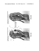METHOD FOR MEASURING PATIENT POSTURE AND VITAL SIGNS diagram and image