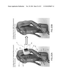 METHOD FOR CONTINUOUSLY MONITORING A PATIENT USING A BODY-WORN DEVICE AND ASSOCIATED SYSTEM FOR ALARMS/ALERTS diagram and image