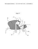 LIVING BODY INFORMATION DETECTION APPARATUS AND BLOOD-PRESSURE METER diagram and image