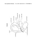 LIVING BODY INFORMATION DETECTION APPARATUS AND BLOOD-PRESSURE METER diagram and image