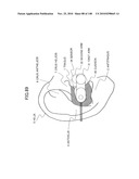 LIVING BODY INFORMATION DETECTION APPARATUS AND BLOOD-PRESSURE METER diagram and image