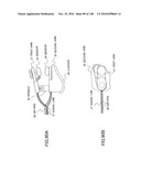 LIVING BODY INFORMATION DETECTION APPARATUS AND BLOOD-PRESSURE METER diagram and image