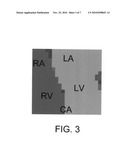 Method of examining dynamic cardiac electromagnetic activity diagram and image