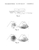 THERAPY ASSESSMENT WITH ULTRASOUND CONTRAST AGENTS diagram and image