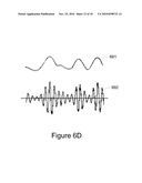 Method and System for Heart Failure Status Evaluation Based on a Disordered Breathing Index diagram and image