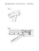 METHODS AND DEVICES FOR LAPAROSCOPIC SURGERY diagram and image