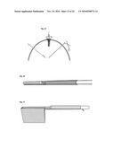 METHODS AND DEVICES FOR LAPAROSCOPIC SURGERY diagram and image