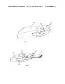 Method and apparatus for extensible intravenous drip line diagram and image