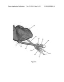 Bipolar Ablation Device, System and Method for Minimally Invasive Isolation of Pulmonary Veins in a Sub-Xiphoid Approach diagram and image