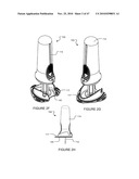 APPARATUS FOR INTRODUCING PORTALS IN BONE HAVING MOVABLE BONE PROBE diagram and image