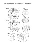 DEVICE AND APPARATUS FOR PERFORMING AN ENDOPROSTHESIS IMPLANTATION diagram and image