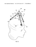 ADJUSTABLE UNIVERSAL SURGICAL PLATFORM diagram and image