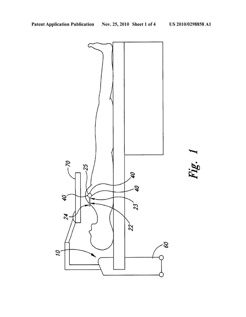 METHODS AND APPARATUS FOR EXTERNAL BEAM RADIATION TREATMENTS OF RESECTION CAVITIES - diagram, schematic, and image 02