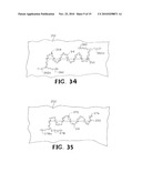 SELF-RETAINING WOUND CLOSURE DEVICE INCLUDING AN ANCHORING LOOP diagram and image