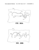 SELF-RETAINING WOUND CLOSURE DEVICE INCLUDING AN ANCHORING LOOP diagram and image