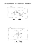 SELF-RETAINING WOUND CLOSURE DEVICE INCLUDING AN ANCHORING LOOP diagram and image