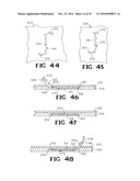 SELF-RETAINING WOUND CLOSURE DEVICE INCLUDING AN ANCHORING LOOP diagram and image