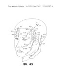 SELF-RETAINING WOUND CLOSURE DEVICE INCLUDING AN ANCHORING LOOP diagram and image